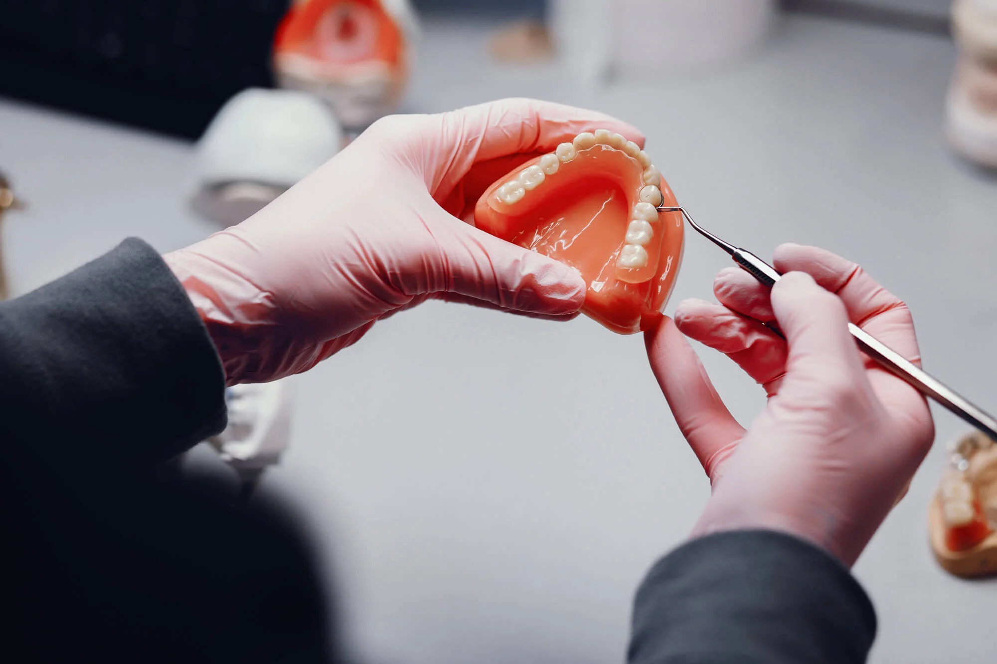 Dentures vs. implants in Katy, TX
