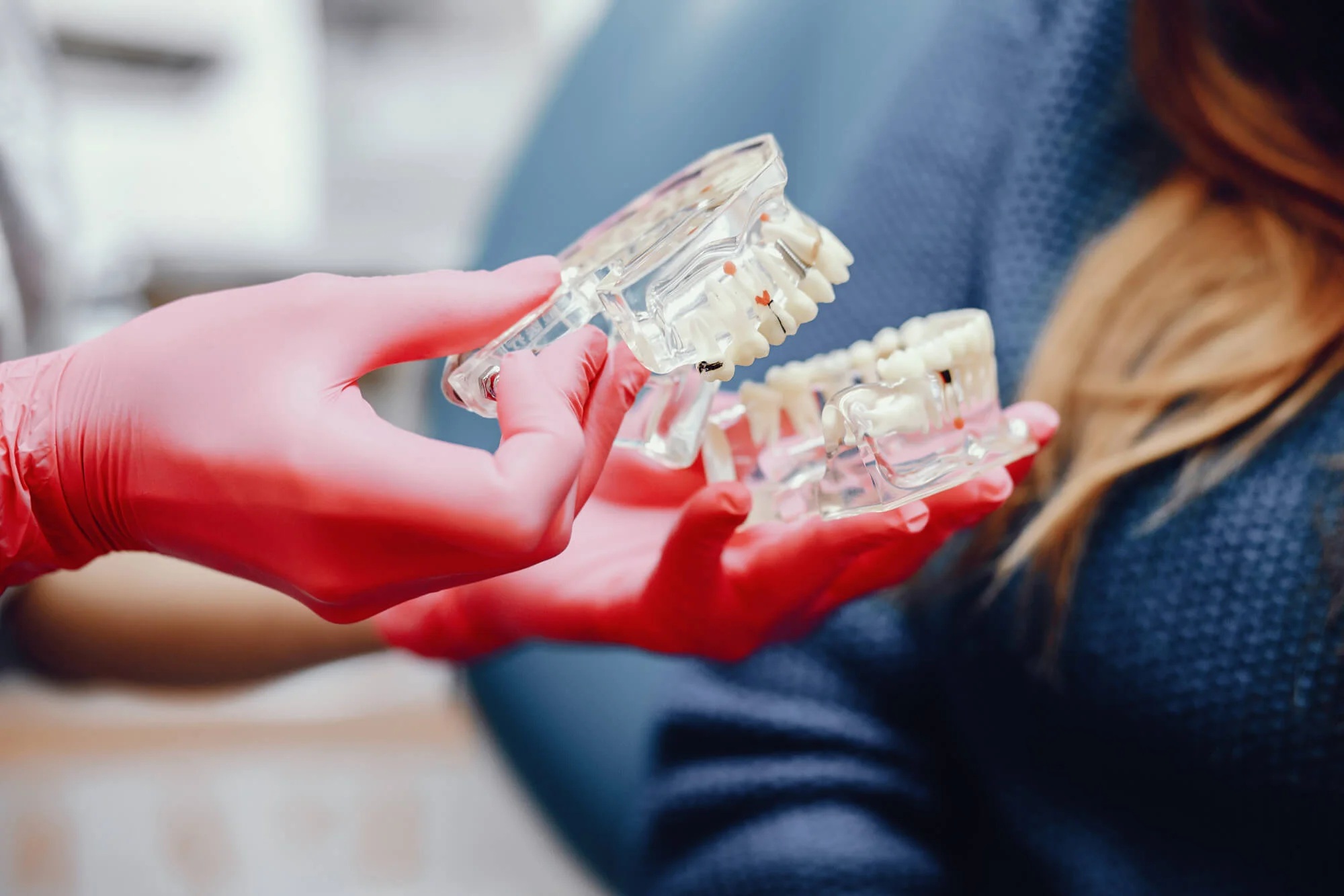 types of dental bridges in Katy, TX